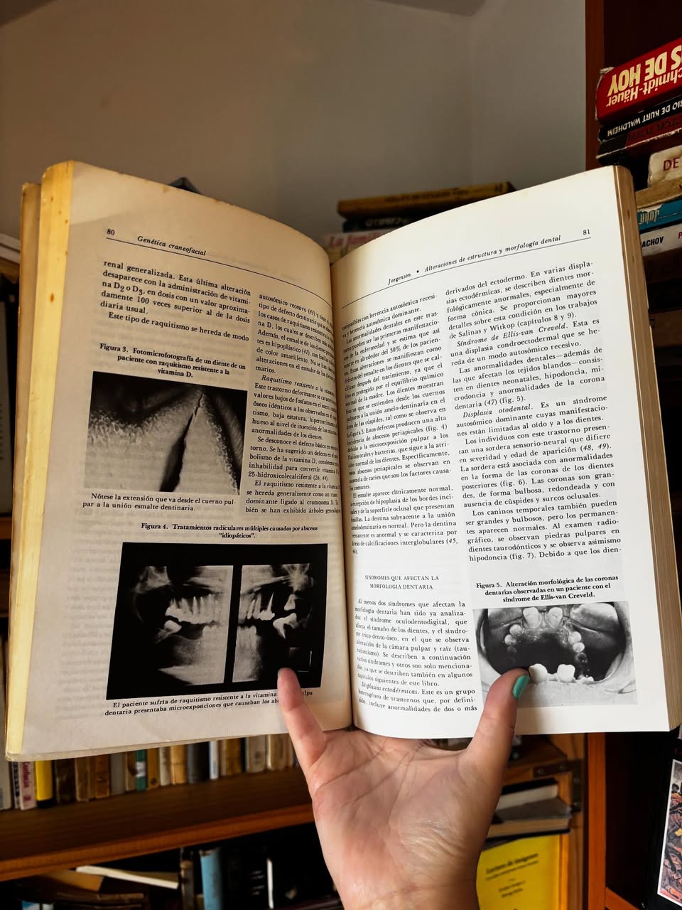 Genética Craneofacial - Imagen 3