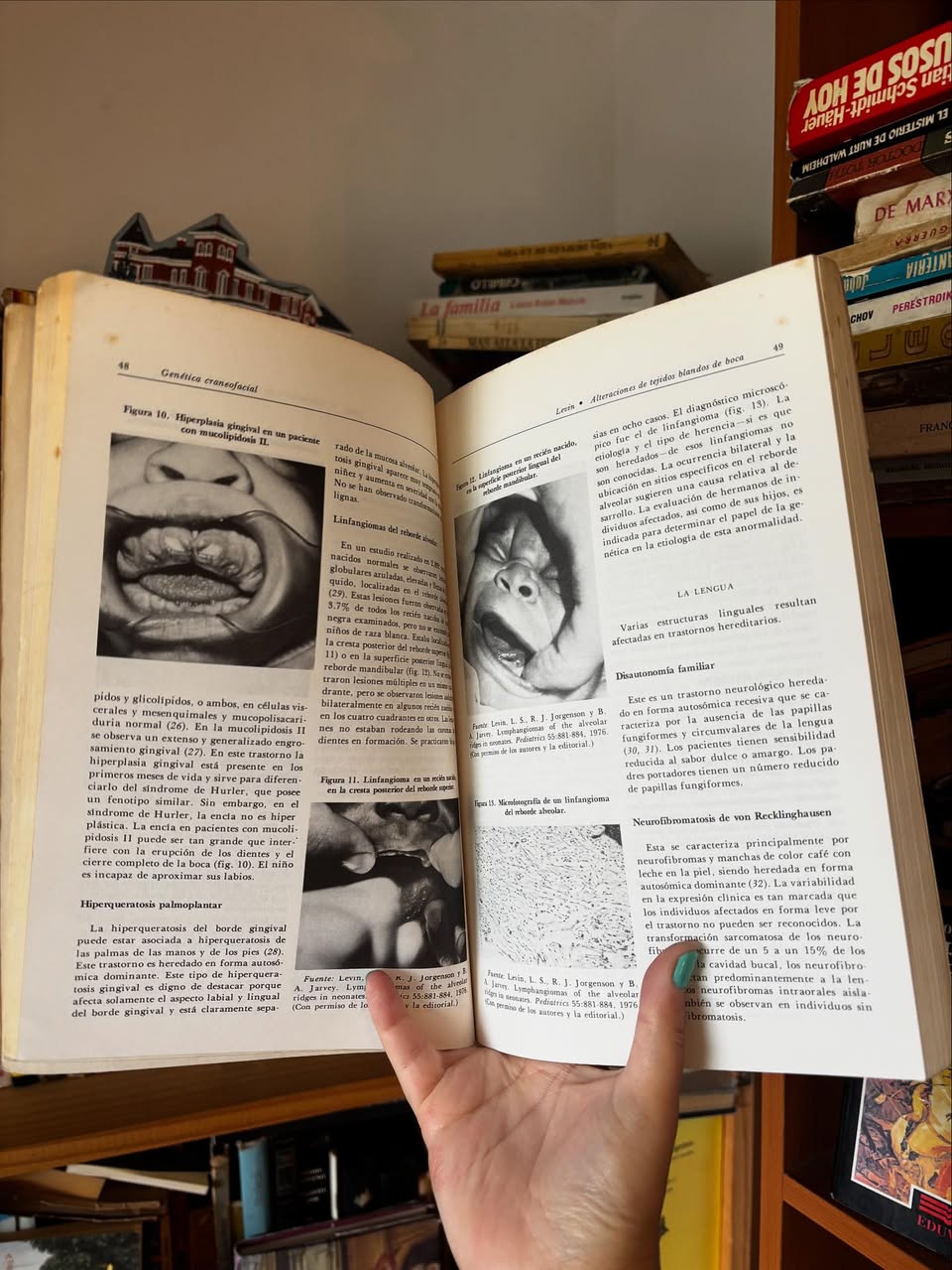 Genética Craneofacial - Imagen 4