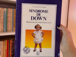 Síndrome de down, programa de acción educativa